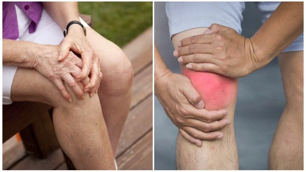 Symptoms of arthrosis