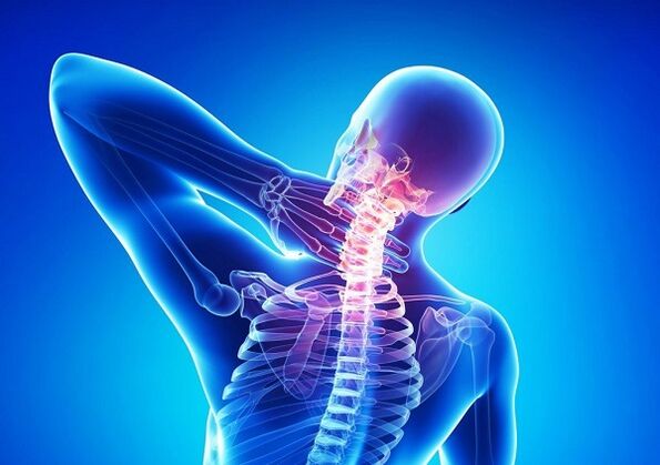 pain in the cervical spine with osteochondrosis