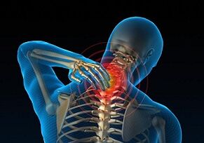 Why develops and how osteochondrosis of the cervical part is manifested